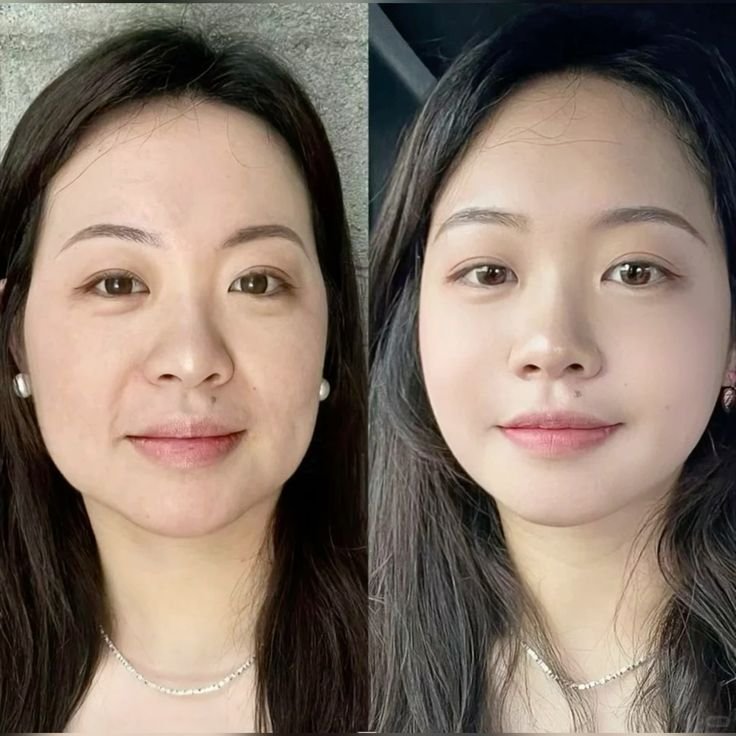 Antes y después - Carla